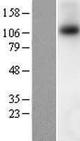 TRPM8 Protein (Over-Expression Lysate Myc-DDK (Flag))