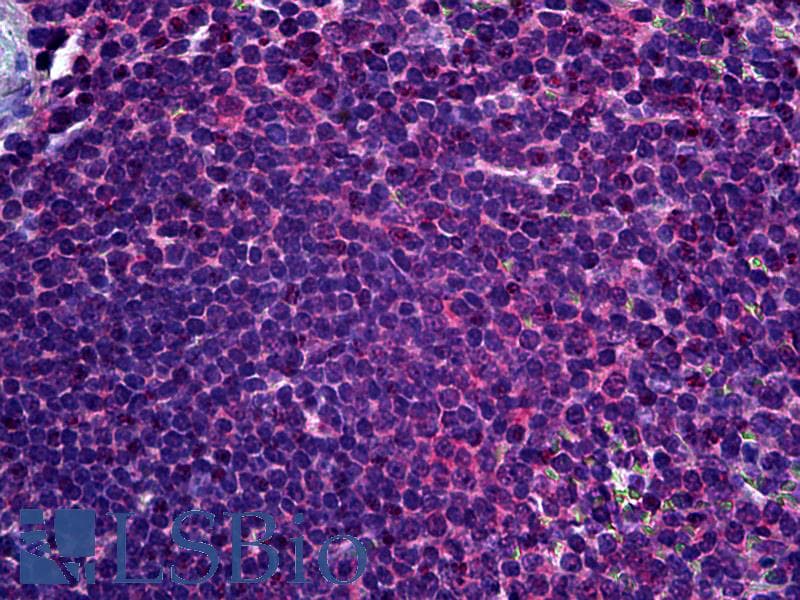 IHC-plus™ FADS1 Antibody (clone 2D9)