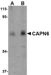 IHC-plus™ Polyclonal Rabbit anti-Human CAPN6 / Calpain 6 Antibody (IHC, IF, WB)