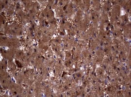 VILIP / VSNL1 Antibody (aa2-191, clone OTI1F7)