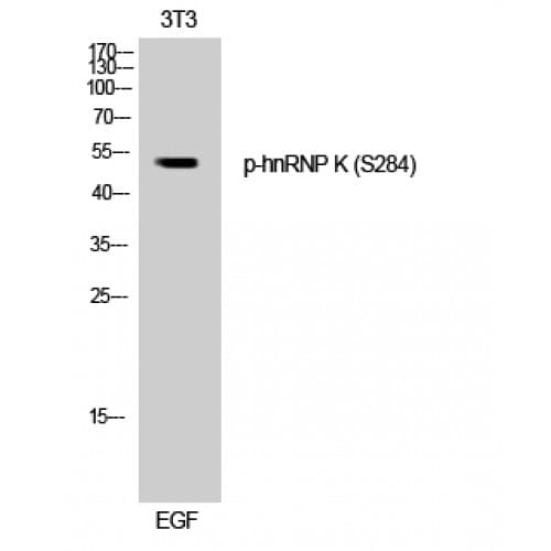 HNRNPK / hnRNP K Antibody (220-300 aa)