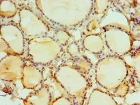 DATF1 / DIDO1 Antibody (aa1-300)