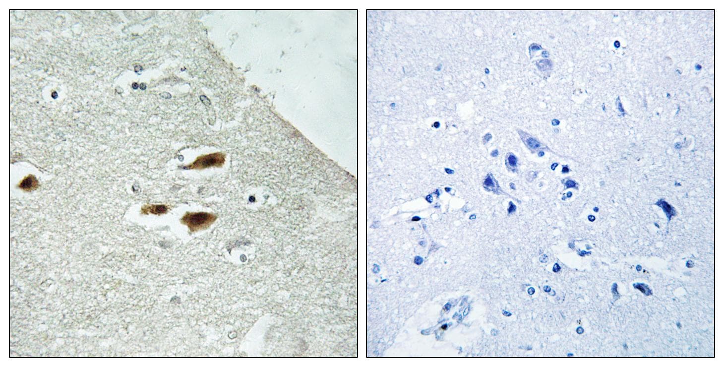 PER2 Antibody (phospho-Ser662)