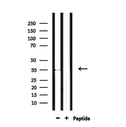 OR4C46 Antibody