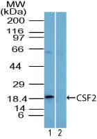 CSF2 / GM-CSF Antibody (aa1-50)