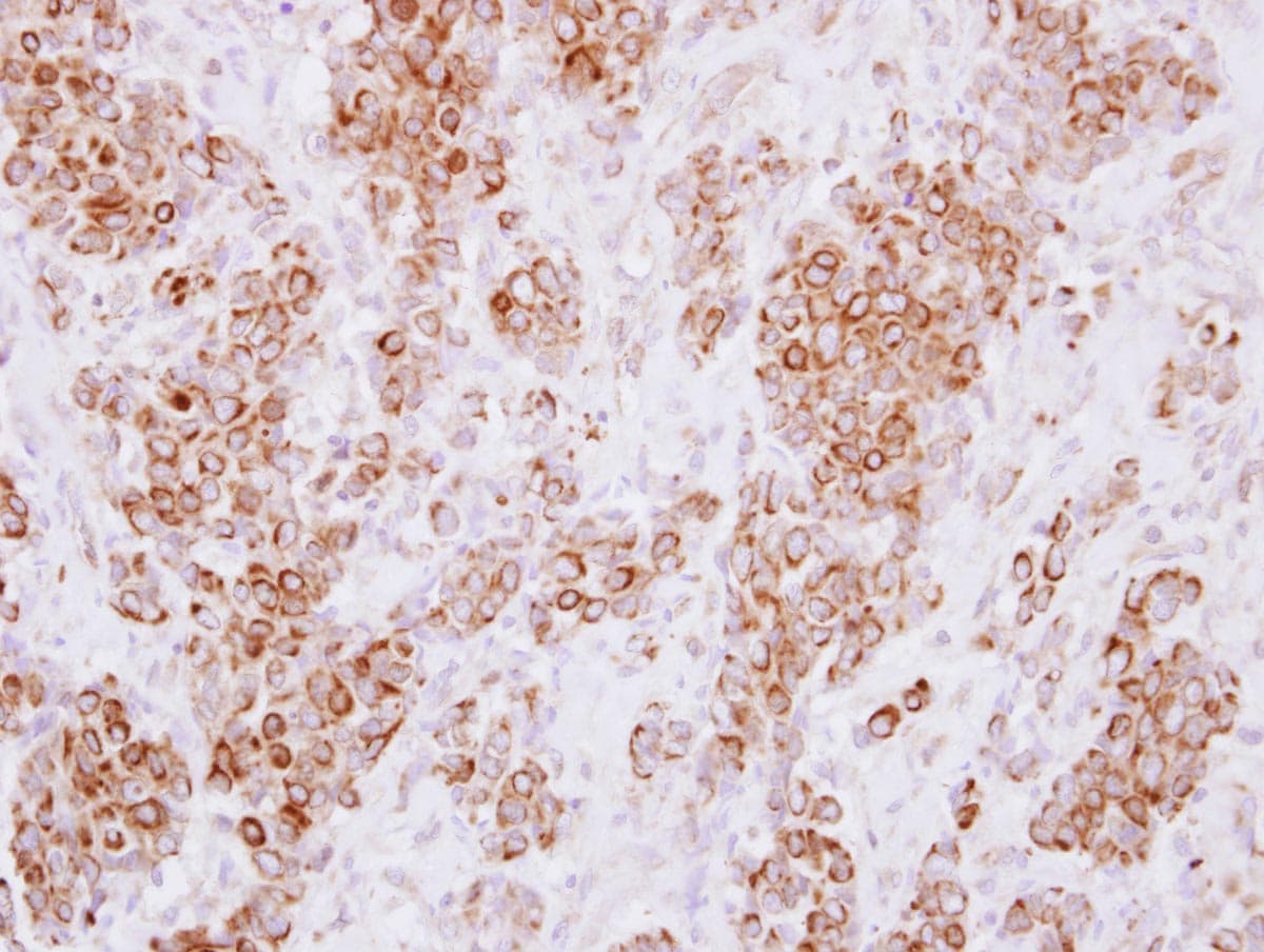 HLA-DMA Antibody (aa52-245)