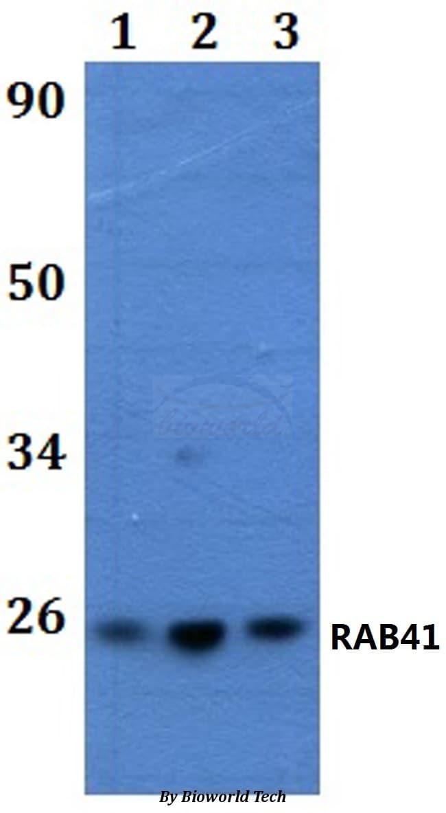 Polyclonal Rabbit anti-Human RAB41 Antibody (WB)