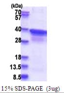Human POLR2C Protein (Recombinant His)