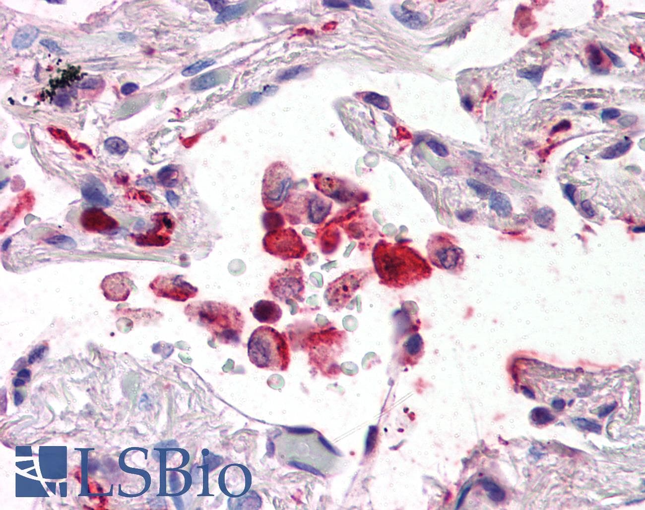 IHC-plus™ Polyclonal Goat anti-Human AIF1 / IBA1 Antibody (aa149-161, IHC, WB)