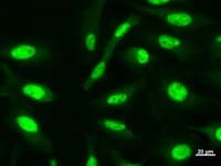 CHD6 Antibody (clone 2174C2a)