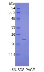 Mouse IL17RB Protein (Recombinant His)