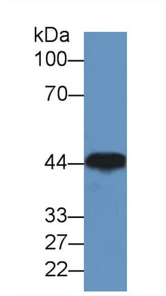 CKM / Creatine Kinase MM Antibody (aa11-367)