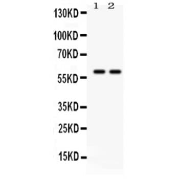 TH / Tyrosine Hydroxylase Antibody (aa193-222)