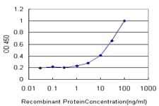 CBR / CBR1 Antibody (clone 4G11-1C7)