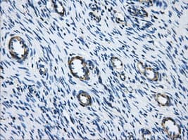 ACO2 / Aconitase 2 Antibody (clone OTI3G8)