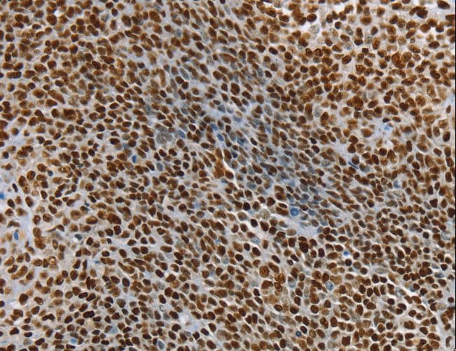 SSB / La Antibody