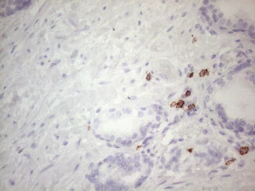 Monoclonal Mouse anti-Human c-Kit / CD117 Antibody (clone OTI2B12, aa27-308, IHC, WB)