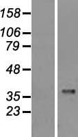 CASP1 / Caspase 1 Protein (Over-Expression Lysate Myc-DDK (Flag))