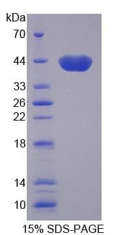 Human RTKN / Rhotekin Protein (Recombinant)