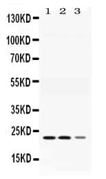 AK1 / Adenylate Kinase 1 Antibody