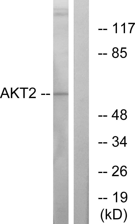 Polyclonal Rabbit anti-Human AKT2 Antibody (aa432-481, IHC, WB)