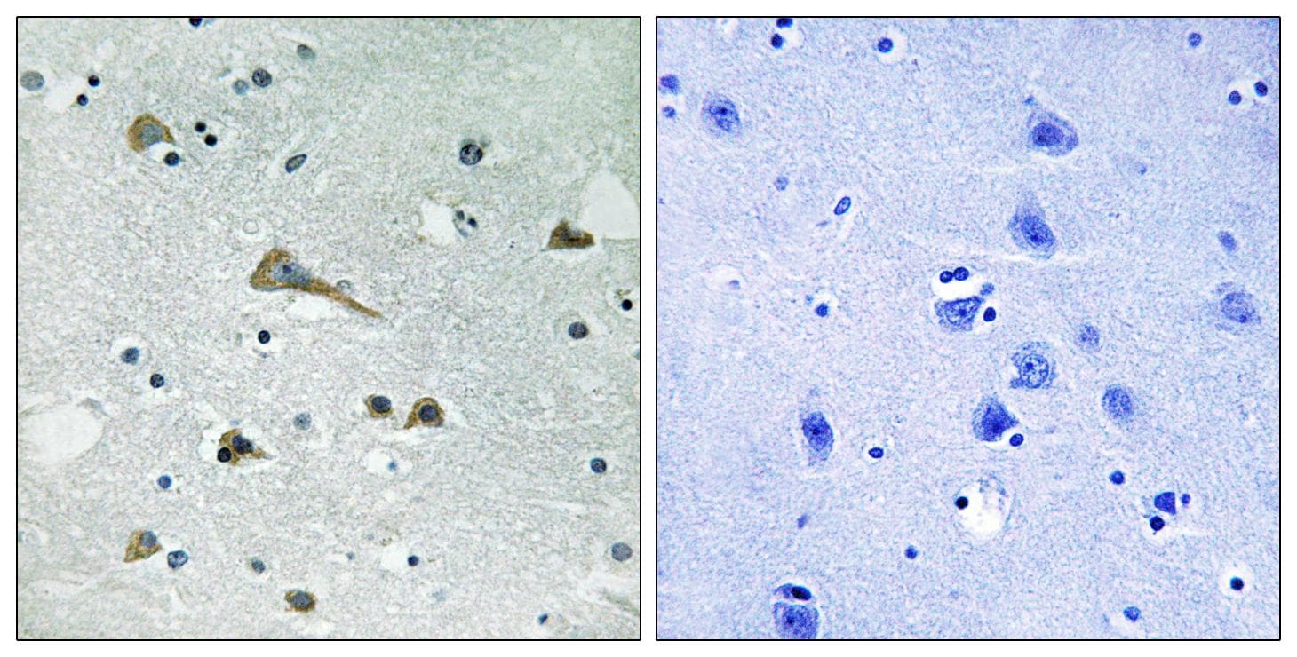 TIRAP Antibody