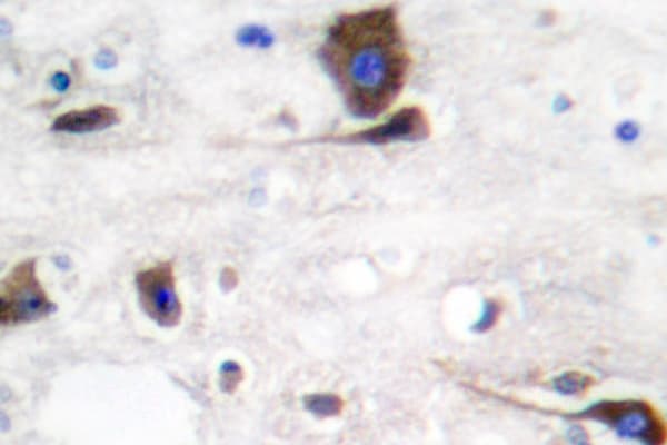 NRG1 / Heregulin / Neuregulin Antibody (Tyr4)