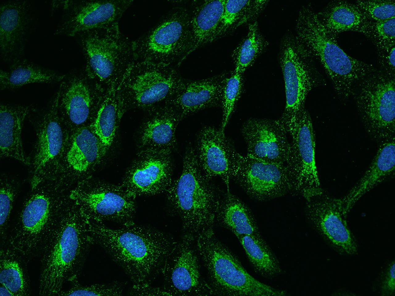 QCR2 / UQCRC2 Antibody