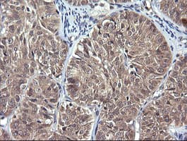 IL1F9 Antibody (clone OTI6E4, Carrier-free)