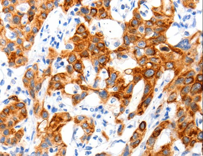 Polyclonal Rabbit anti-Human SLC2A11 / GLUT11 Antibody (IHC)