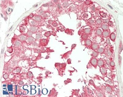 IHC-plus™ Polyclonal Rabbit anti-Human TROVE2 Antibody (aa302-351, IHC, WB)
