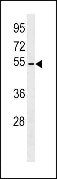 Polyclonal Rabbit anti-Human ZNF577 Antibody (aa83-109, WB)
