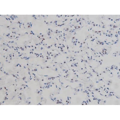 Polyclonal Rabbit anti-Human CHUK / IKKA / IKK Alpha Antibody (phospho-Ser180,phospho-Ser181, IHC, IF, WB)