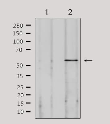 SPAM1 / PH20 Antibody (aa216-244)