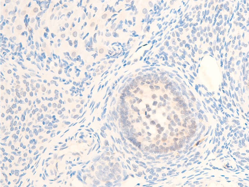 Polyclonal Rabbit anti-Human MITF Antibody (phospho-Ser180,phospho-Ser73, IHC, IF, WB)