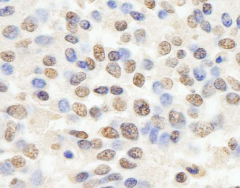 RBBP4 / RBAP48 Antibody (aa1-50)