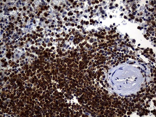 ALOX5 / 5-LOX Antibody (aa18-364, clone OTI1C1)