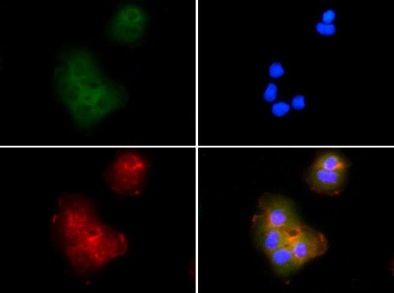 PYCARD / ASC / TMS1 Antibody