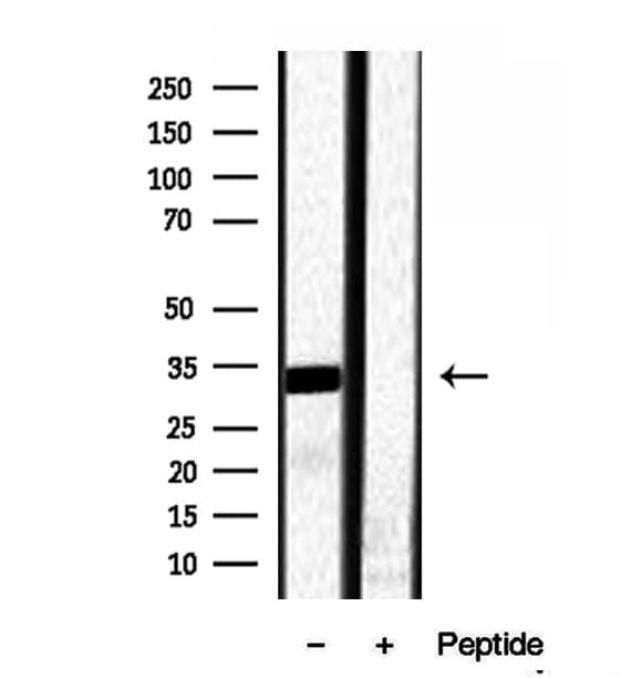 RNASEH1 Antibody