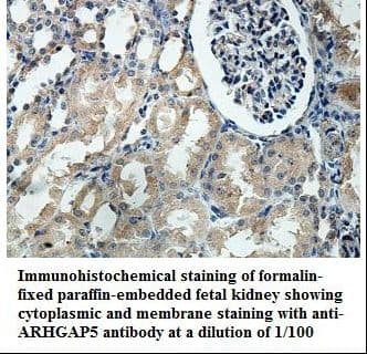 ARHGAP5 / RhoGAP5 Antibody (aa29-210)