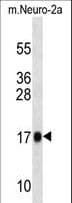 Polyclonal Rabbit anti-Mouse RPL13A Antibody (aa28-54, WB)