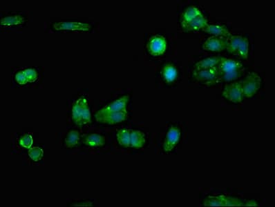 Polyclonal Rabbit anti-Human RGN / Regucalcin Antibody (IHC, IF, WB)