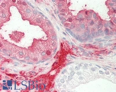 IHC-plus™ Polyclonal Sheep anti-Human A2M / Alpha-2-Macroglobulin Antibody (IHC)