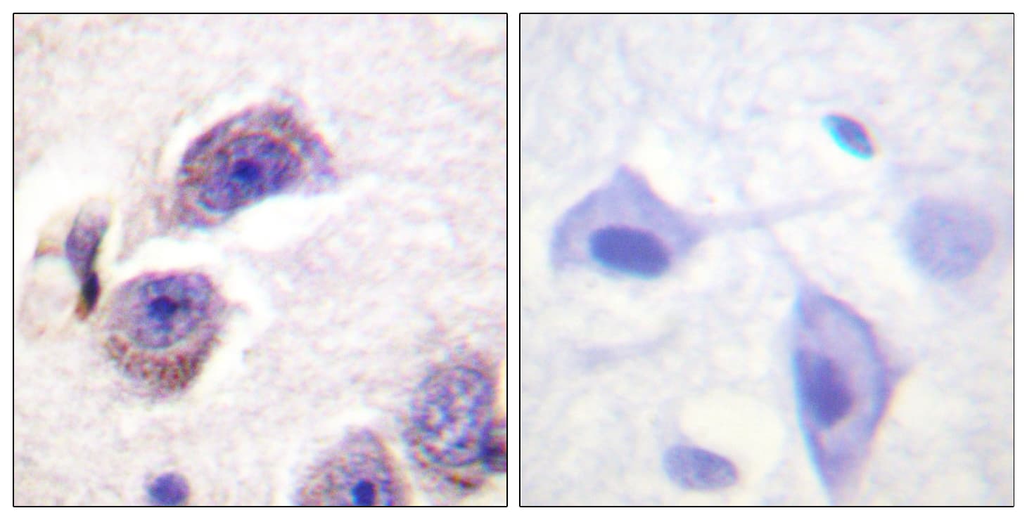 FAK / Focal Adhesion Kinase Antibody (phospho-Tyr407)