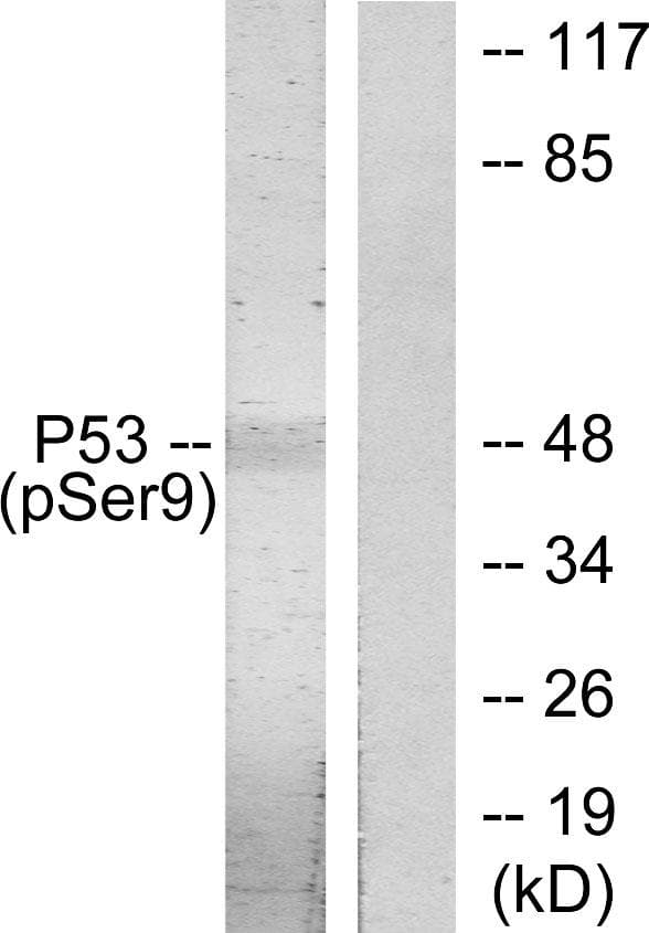TP53 / p53 Antibody (phospho-Ser9)