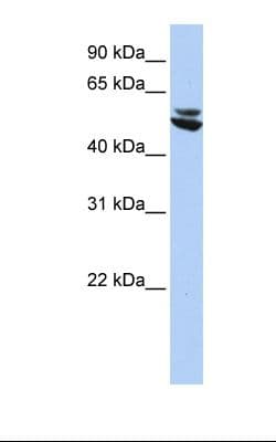Polyclonal Rabbit anti-Human KRT7 / CK7 / Cytokeratin 7 Antibody (N-Terminus, IHC, WB)