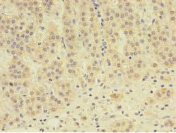 EPHX2 / Epoxide Hydrolase 2 Antibody (aa1-555)