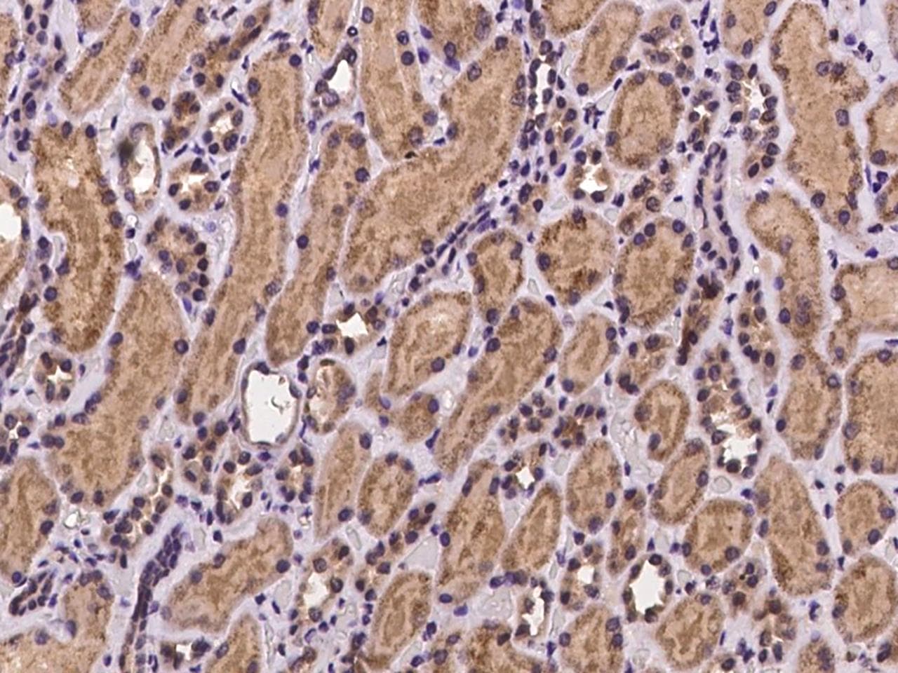 Polyclonal Rabbit anti-Human ZNF799 Antibody (IHC)