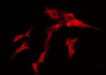 Polyclonal Rabbit anti-Human SLC28A2 Antibody (IHC, IF, WB)