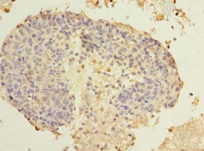 Polyclonal Rabbit anti-Human SPRYD5 Antibody (IHC, WB)